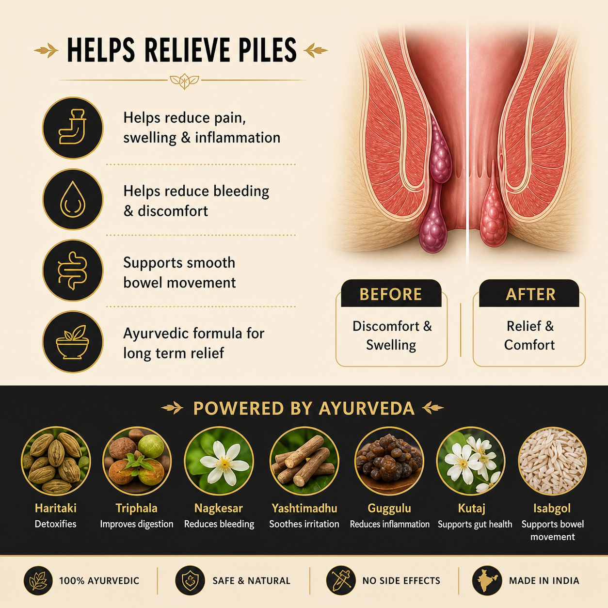 Mitraveda Arshomitra Complete Piles Care Combo